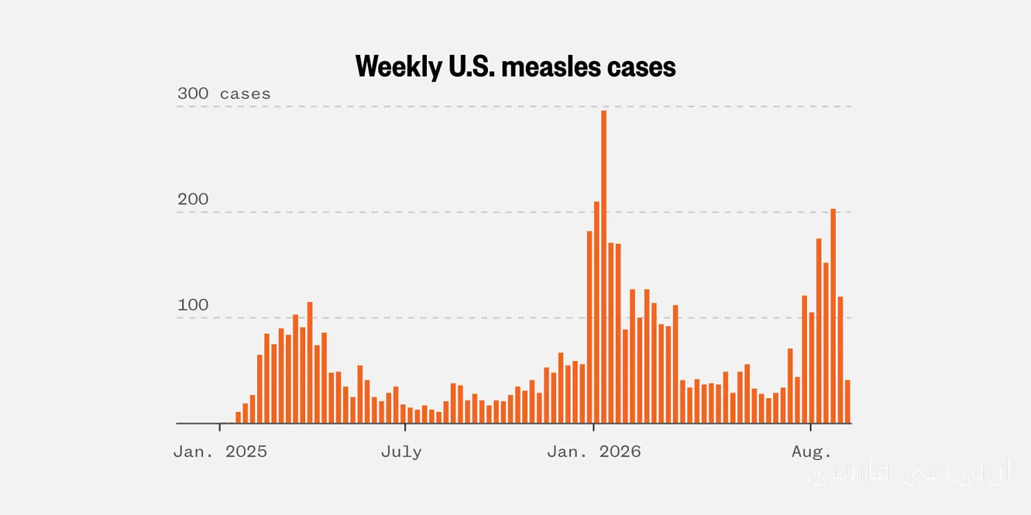 شیوع سرخک در ایالات متحده: وضعیتی نگران‌کننده!